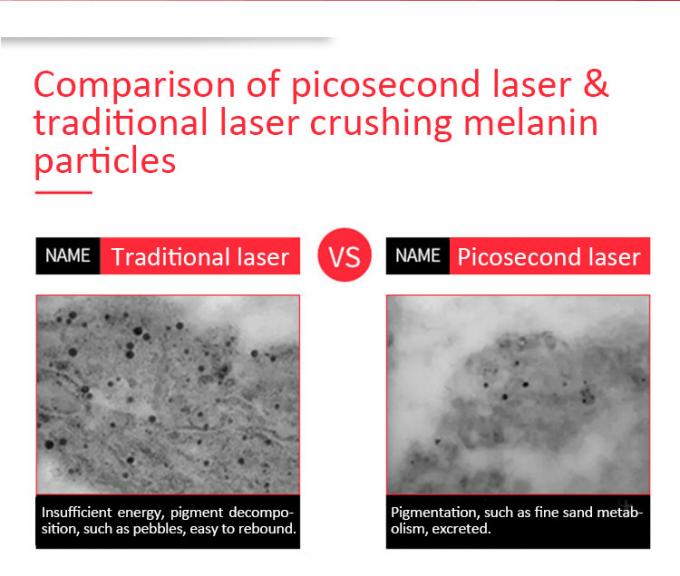 laser potente del picosegundo 900ps para modo homogéneo 1 del punto del retiro del tatuaje el alto