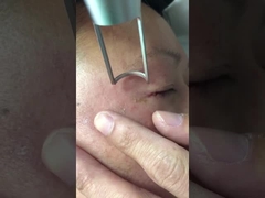 Nd de c4q conmutado Yag de la máquina 1064nm 532nm del laser del picosegundo 450ps