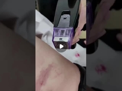 Máquina de microagujas de RF fraccionada de 50W de 100V a 240V