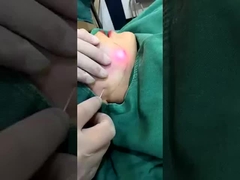 Máquina de reducción de grasa de diodo láser profesional de 1470nm Resultados visibles en 2-3 sesiones