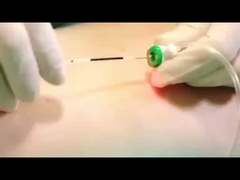 Máquina de lipólisis con láser