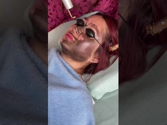 Elevación facial 585nm 650nm Dispositivo láser de picosegundos 500ps 750ps 2000ps